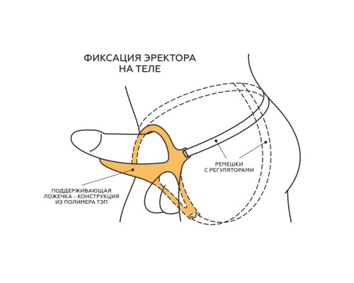 Заказать Телесный эректор-ложечка с фиксацией на ремешках MEN STYLE Заказать Телесный эректор-ложечка с фиксацией на ремешках MEN STYLE