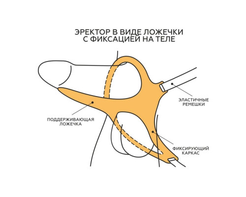 Заказать Телесный эректор-ложечка с фиксацией на ремешках MEN STYLE Заказать Телесный эректор-ложечка с фиксацией на ремешках MEN STYLE